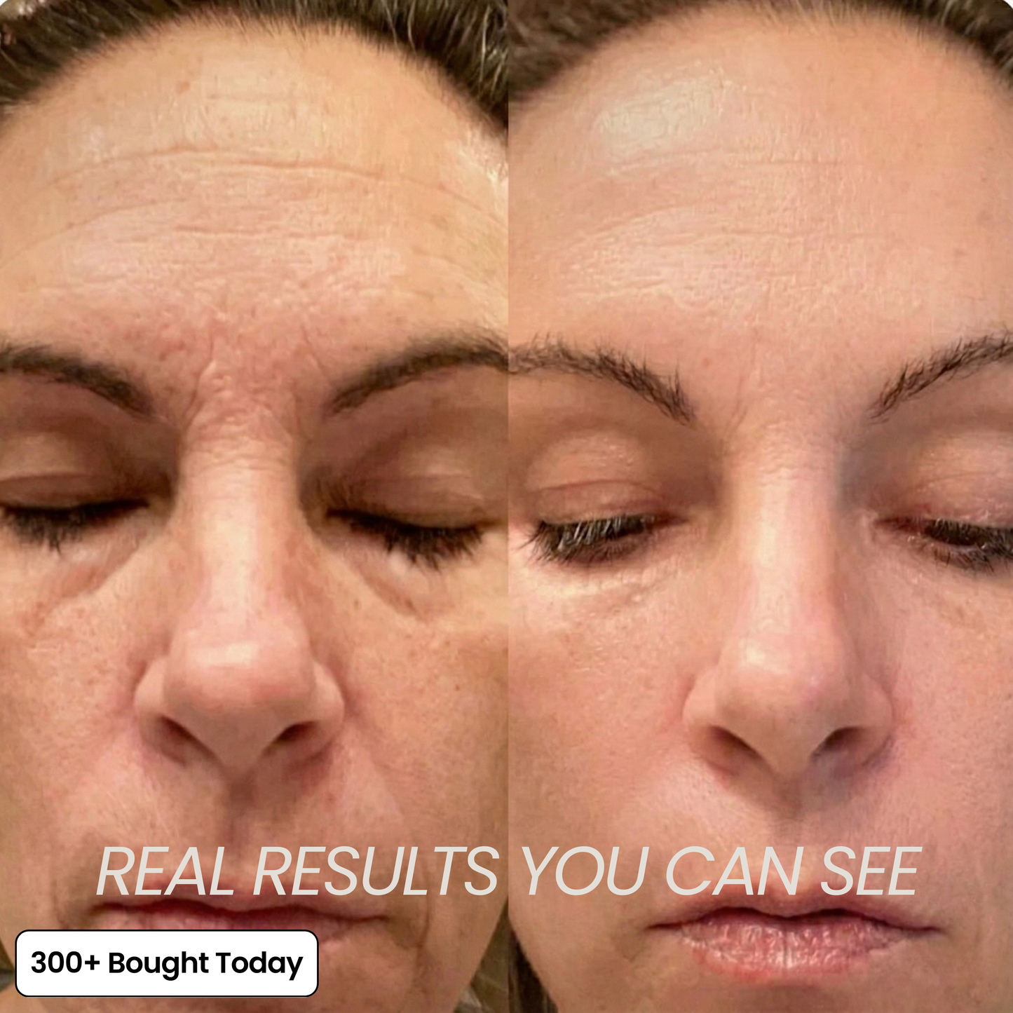🔥STOP SCROLLING 👀  THIS STICK IS CHANGING SKINCARE  ✨ Brighter Skin in Seconds