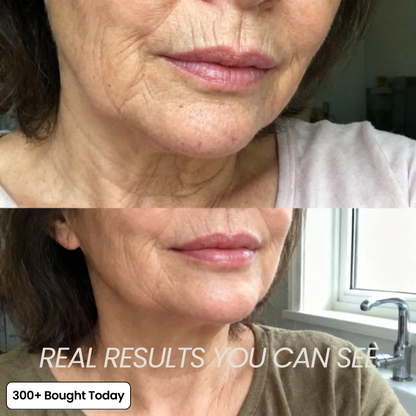 🔥STOP SCROLLING 👀  THIS STICK IS CHANGING SKINCARE  ✨ Brighter Skin in Seconds