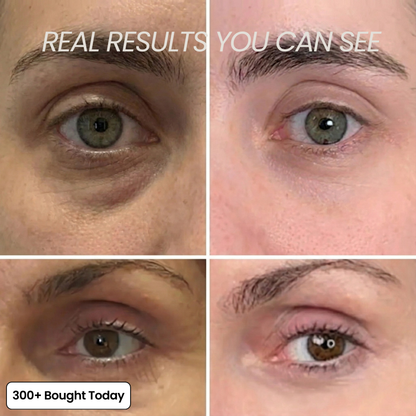🔥STOP SCROLLING 👀  THIS STICK IS CHANGING SKINCARE  ✨ Brighter Skin in Seconds