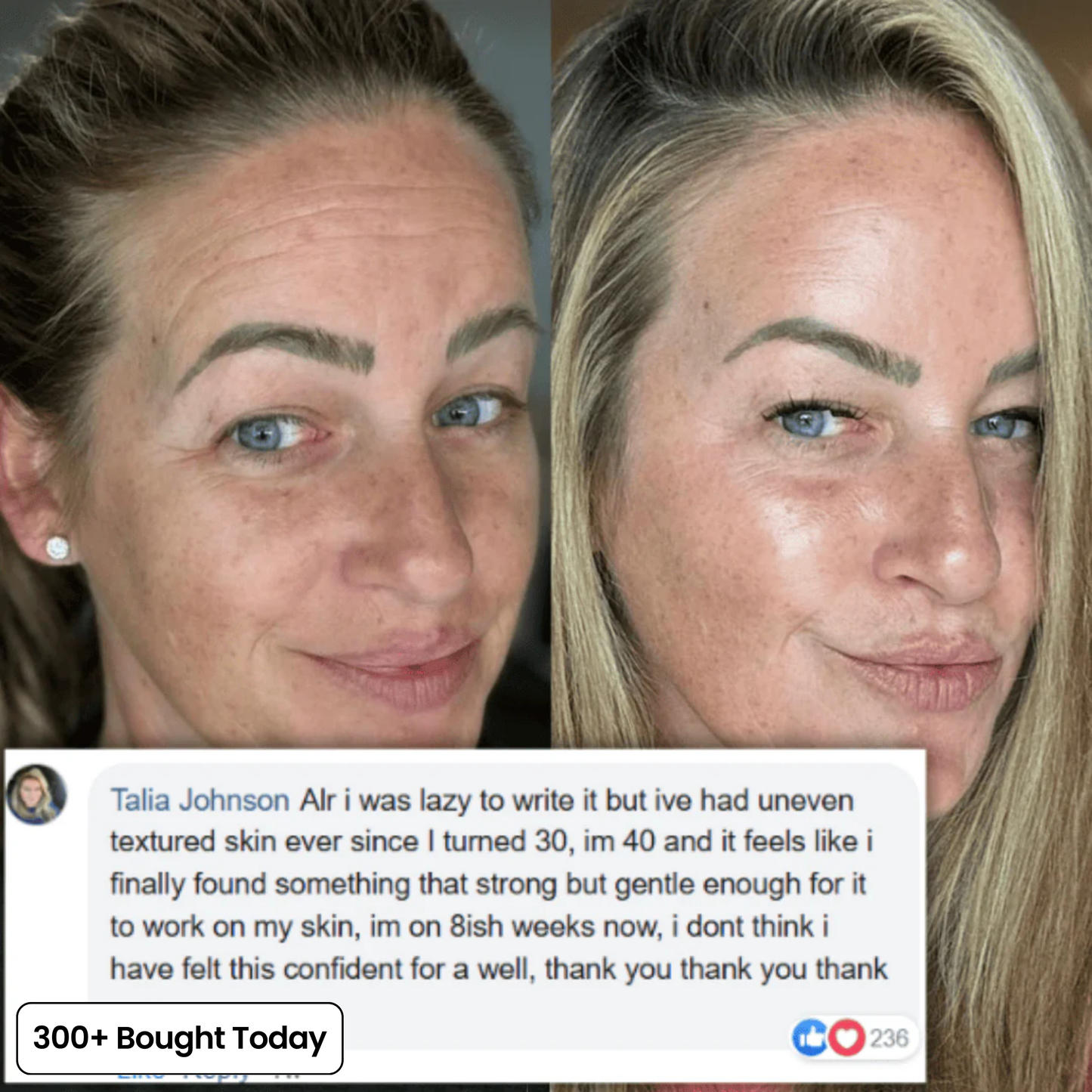 🔥STOP SCROLLING 👀  THIS STICK IS CHANGING SKINCARE  ✨ Brighter Skin in Seconds