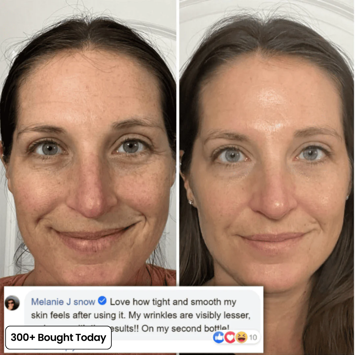 🔥STOP SCROLLING 👀  THIS STICK IS CHANGING SKINCARE  ✨ Brighter Skin in Seconds